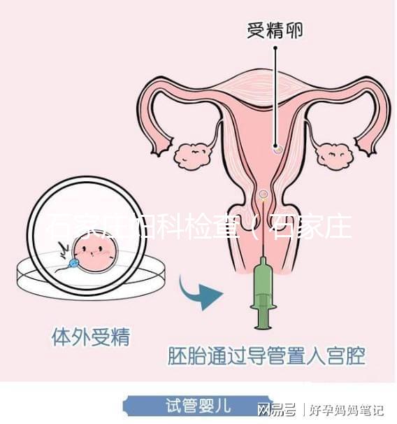 石家莊婦科檢查(石家莊最好婦科的醫(yī)院)