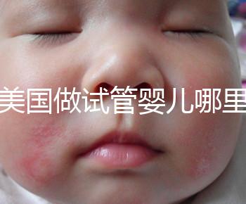 去美國(guó)做試管嬰兒哪里最好，4家好評(píng)輔助生殖機(jī)構(gòu)推薦