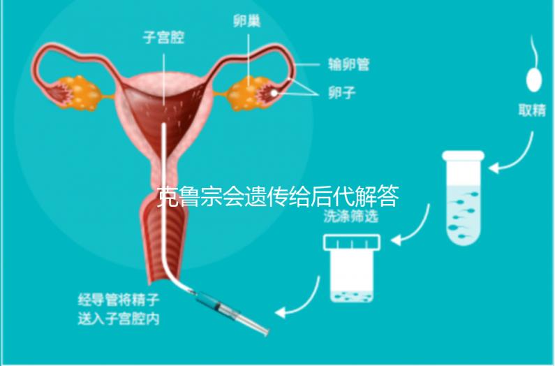克魯宗會遺傳給后代解答嗎？他生來就有一篇清晰的文章嗎？
