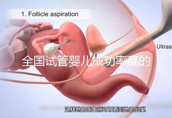 全國試管嬰兒成功率高的醫(yī)院排名，內(nèi)附2023試管費用及成功率參考