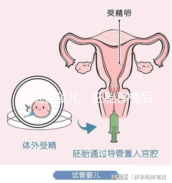 做試管嬰兒，胚胎移植后需要住院嗎？