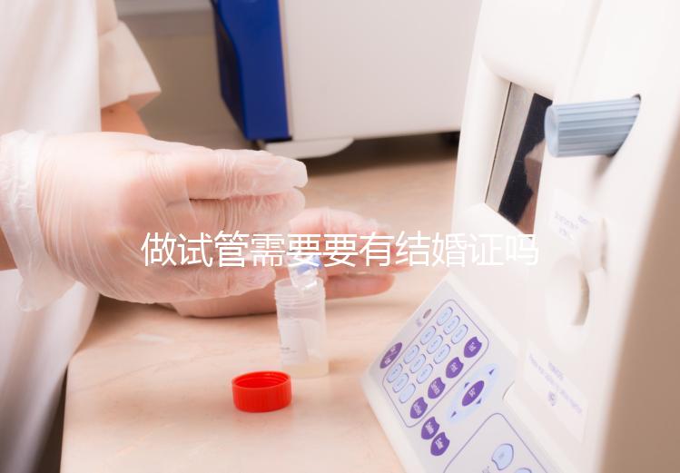 做試管需要要有結婚證嗎？做試管需要結婚證