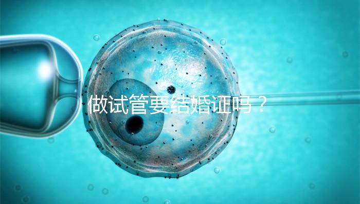 做試管要結(jié)婚證嗎？