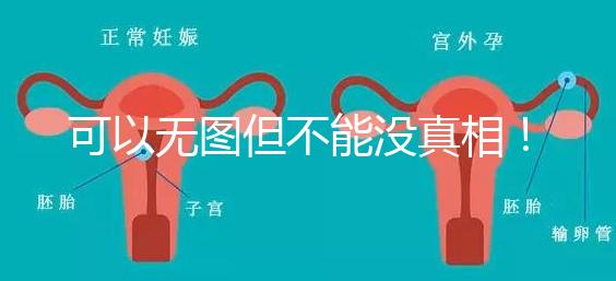 可以無圖但不能沒真相！段濤大夫帶你了解B超檢查報(bào)告單