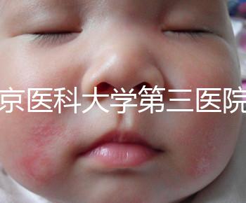 北京醫(yī)科大學(xué)第三醫(yī)院nt檢查費用盤點需要多長時間，是否預(yù)約