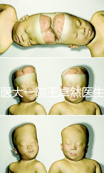 哈醫(yī)大一院王卓然醫(yī)生試管攻略,坐診時間、成功率早知道