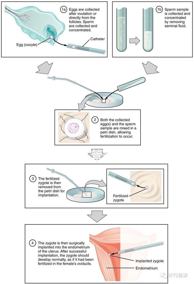 國內(nèi)首起試管嬰兒案例，法律竟難以給患者維權(quán)