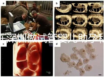 在深圳做試管嬰兒助孕私人機構收費標準是怎樣的