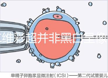 二維彩超并非黑白呈像，通過檢查還能看清胎兒五官