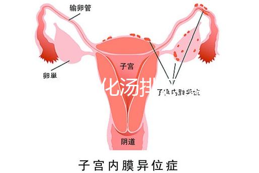 產(chǎn)后喝生化湯排惡露會使寶寶拉肚子?醫(yī)生:時間沒用對