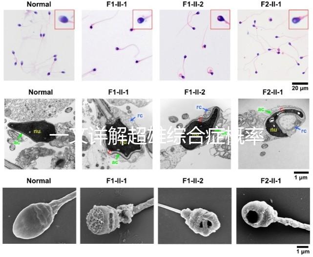 一文詳解超雄綜合癥概率有多大，想造的人多不多看過來