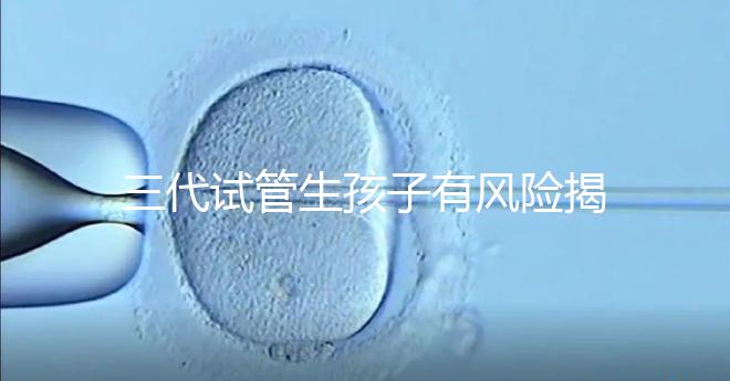 三代試管生孩子有風險揭秘嗎？嬰兒會有問題嗎？