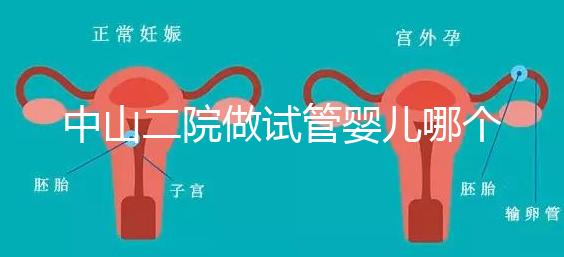 中山二院做試管嬰兒哪個(gè)醫(yī)生好?附醫(yī)院試管成功率