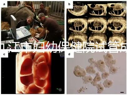 九江市婦幼保健院試管成功率高、費用低？生殖醫生揭開真相