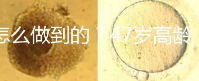怎么做到的？47歲高齡試管嬰兒唯一男胚一次移植成功！