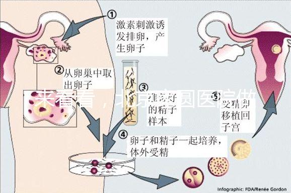 來看看，北京家圓醫院做三代試管費用總共多少？