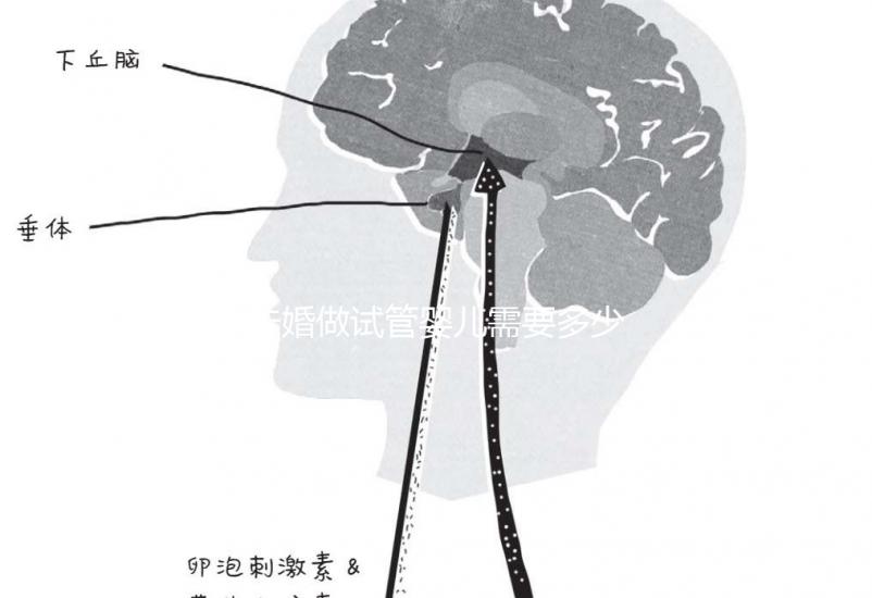 未婚做試管嬰兒需要多少錢？公立醫院費用大概在3-12萬