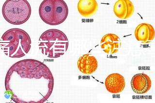 無痛人流有哪些注意事項(xiàng)?