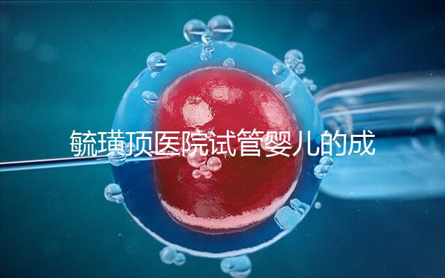 毓璜頂醫(yī)院試管嬰兒的成功率不低，找對(duì)生殖科大夫是關(guān)鍵
