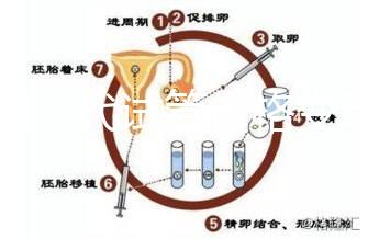 泰國(guó)三代試管價(jià)格變動(dòng),2025年最新費(fèi)用行情一覽