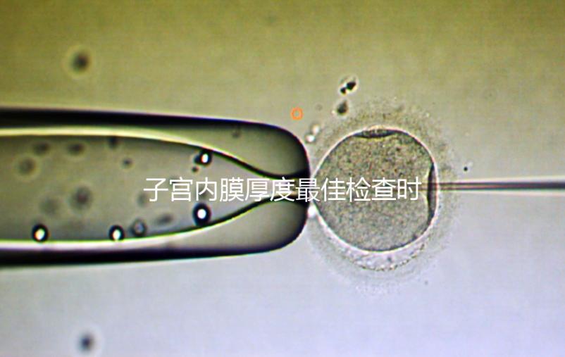 子宮內(nèi)膜厚度最佳檢查時期,你有必要提前知道!