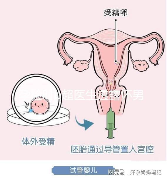 孕檢時b超醫(yī)生透露懷男寶女寶暗語寶典，一語戳中有心人！
