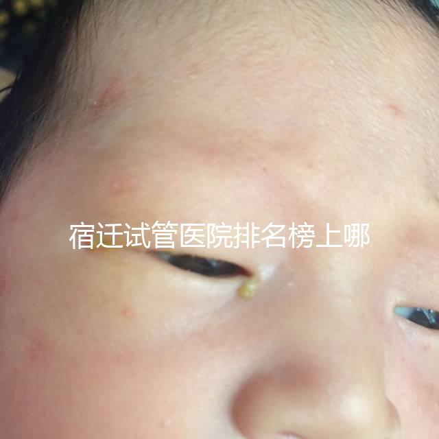 宿遷試管醫院排名榜上哪家好，不造助孕成功率和費用別亂選