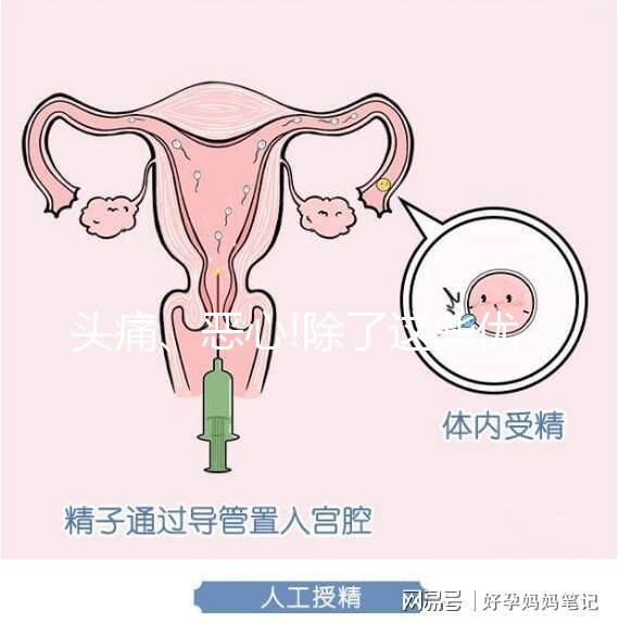 頭痛、惡心!除了這些優思明副作用還有哪些