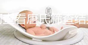 如何查看唐氏篩查結(jié)果，珠海醫(yī)院價格二百四起