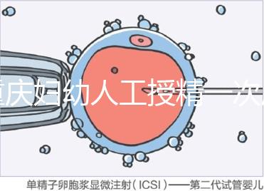 重慶婦幼人工授精一次成功率揭秘，移植費用貴有原因