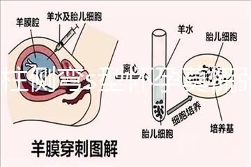 脊柱側彎s型懷孕莫慌張，能否順產還得看這4大要素