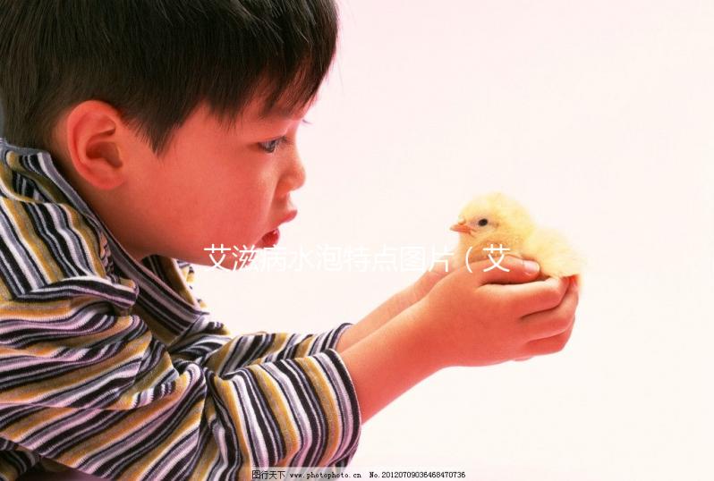 艾滋病水泡特點圖片（艾滋病水泡特點圖片高清）