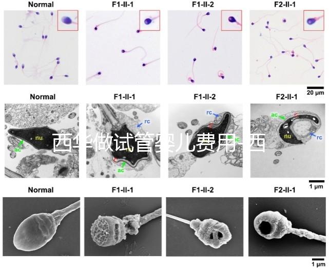 西華做試管嬰兒費用-西華醫院試管嬰兒花費明細表