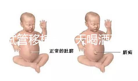 試管移植前幾天喝酒了有影響嗎？想要懷孕得管住嘴！