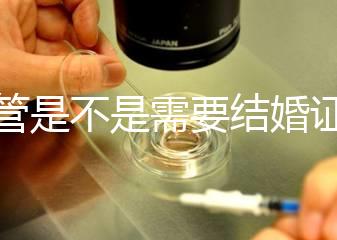 試管是不是需要結(jié)婚證，做試管是不是要結(jié)婚證