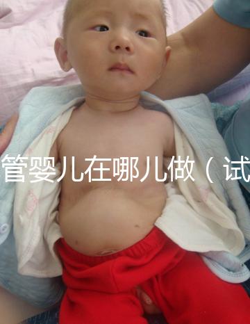 試管嬰兒在哪兒做（試管嬰兒在哪兒做最好啊）