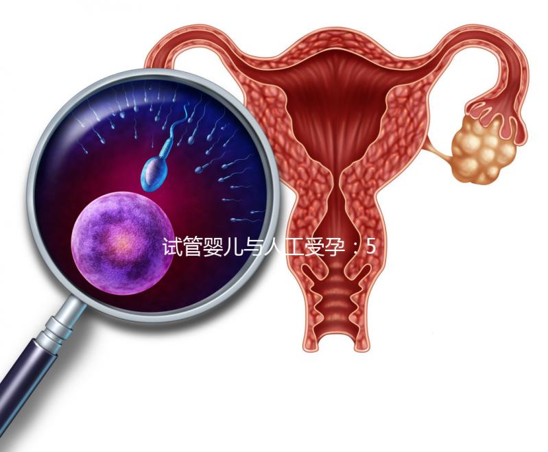 試管嬰兒與人工受孕：5個關鍵區別