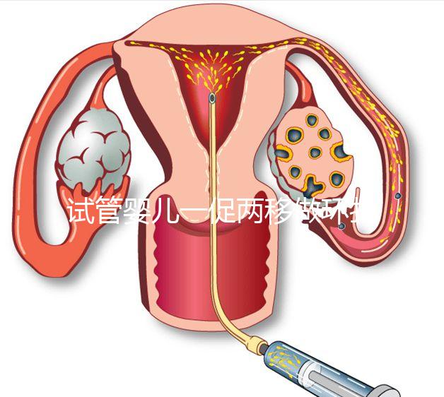 試管嬰兒一促兩移做環扎好看嗎？小心這些影響