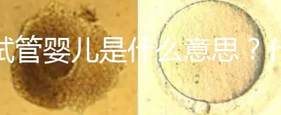 試管嬰兒是什么意思？什么是試管嬰兒？
