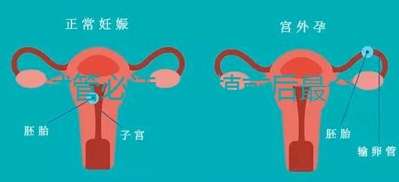 試管必讀，移植前后最全注意事項(xiàng)？