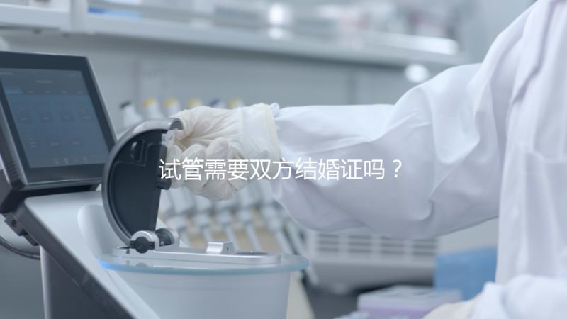 試管需要雙方結(jié)婚證嗎？試管是不是需要結(jié)婚證