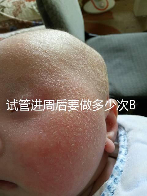 試管進周后要做多少次B超？需要檢查什么？進來看看