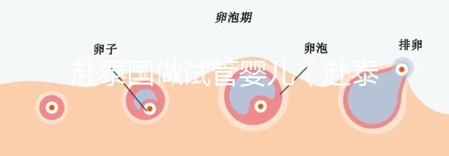 赴泰國(guó)做試管嬰兒（赴泰國(guó)做試管嬰兒要多少錢）