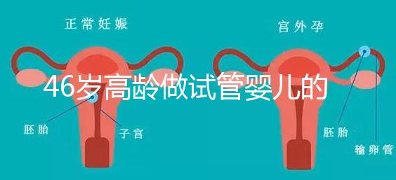 46歲高齡做試管嬰兒的成功幾率有多大？聽聽大家怎么說