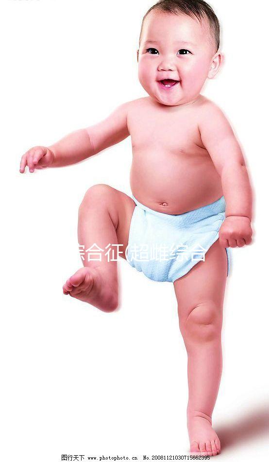 XXX綜合征(超雌綜合征)是什么？一種性染色體異常的疾病