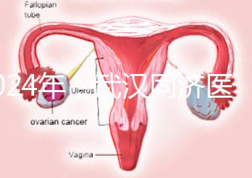 2024年，武漢同濟(jì)醫(yī)院不孕癥醫(yī)生排名公布，選擇專家迅速登記