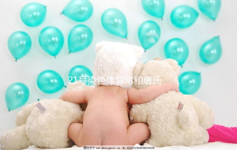 21號染色體異常和唐氏綜合癥關系不小，你肯定知道